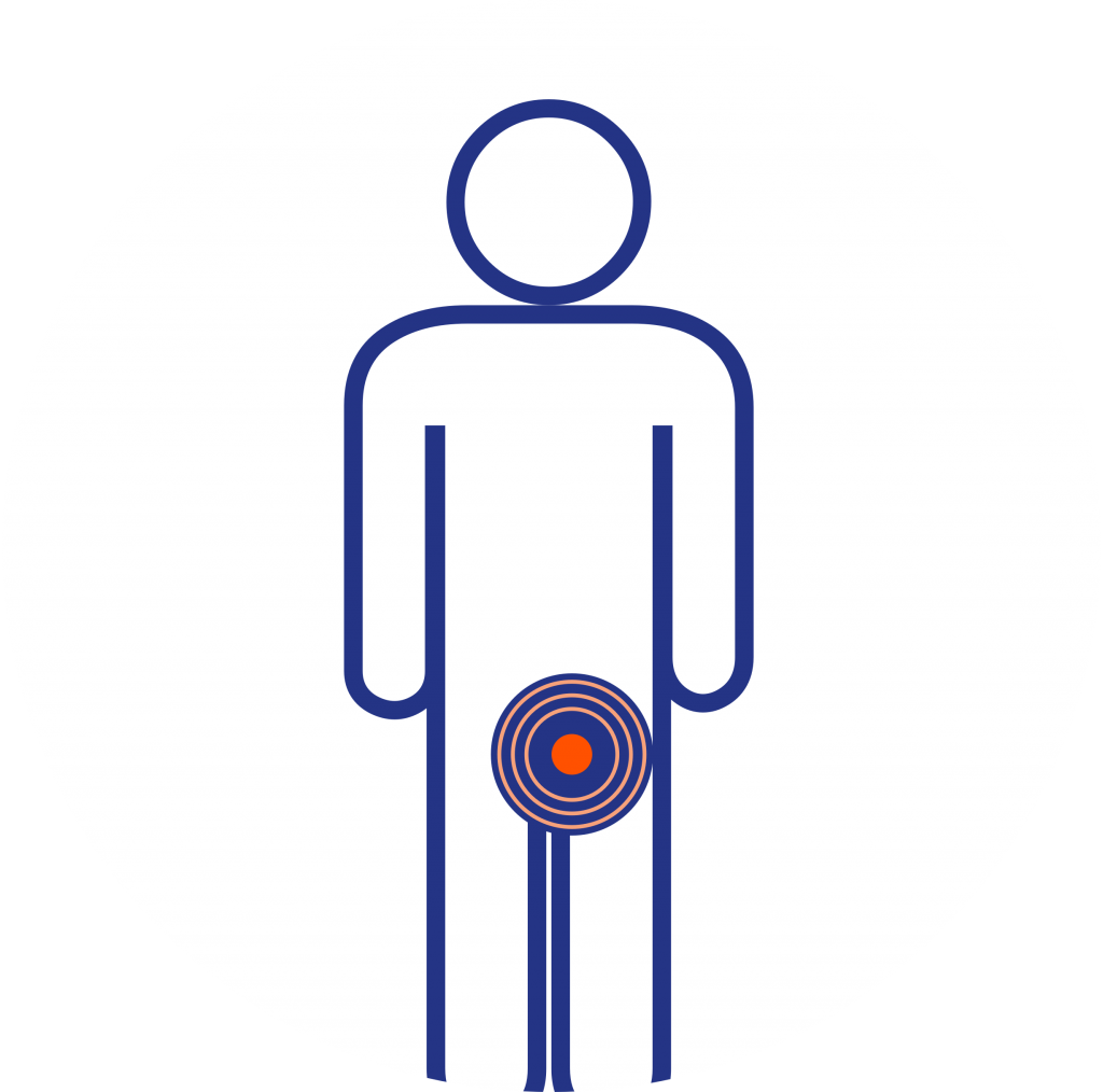 Femoral Hernia (CONTINUED): Surgical Repair of Femoral Hernia